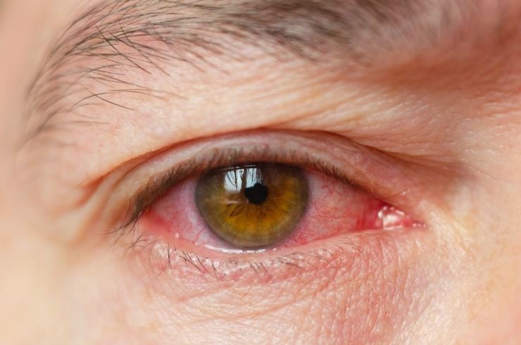 Arka Eye Care