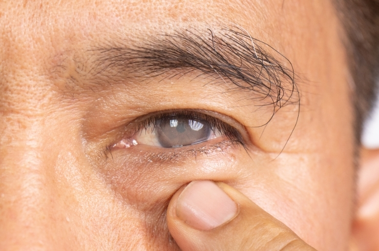 Arka Eye Care